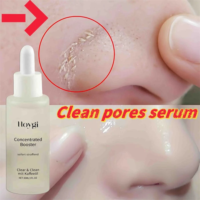 Clean Pores Serum Facial Delicate Tender Moisturizing Oil Control Shrink Pores Rough Skin Smooth Care Brighten Korean Cosmetics