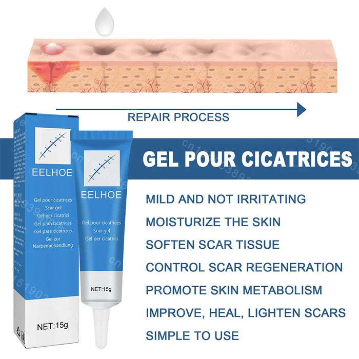 Recovery Scar Cream Fast Removal Skin Scars Treat Surgery Scars Stretch Marks Acne Pox Prints Burn Repair Facial Care Gel