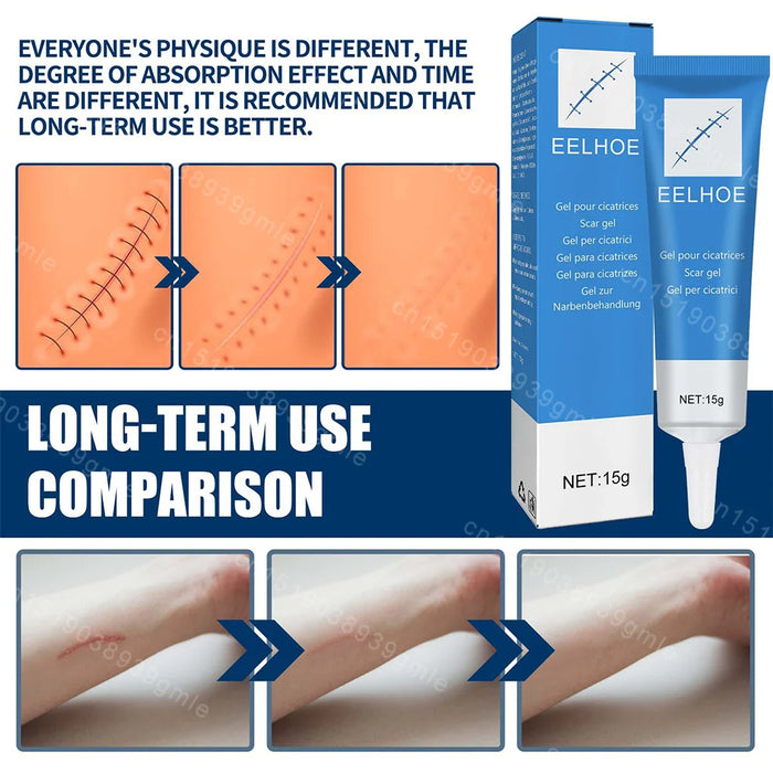 Recovery Scar Cream Fast Removal Skin Scars Treat Surgery Scars Stretch Marks Acne Pox Prints Burn Repair Facial Care Gel