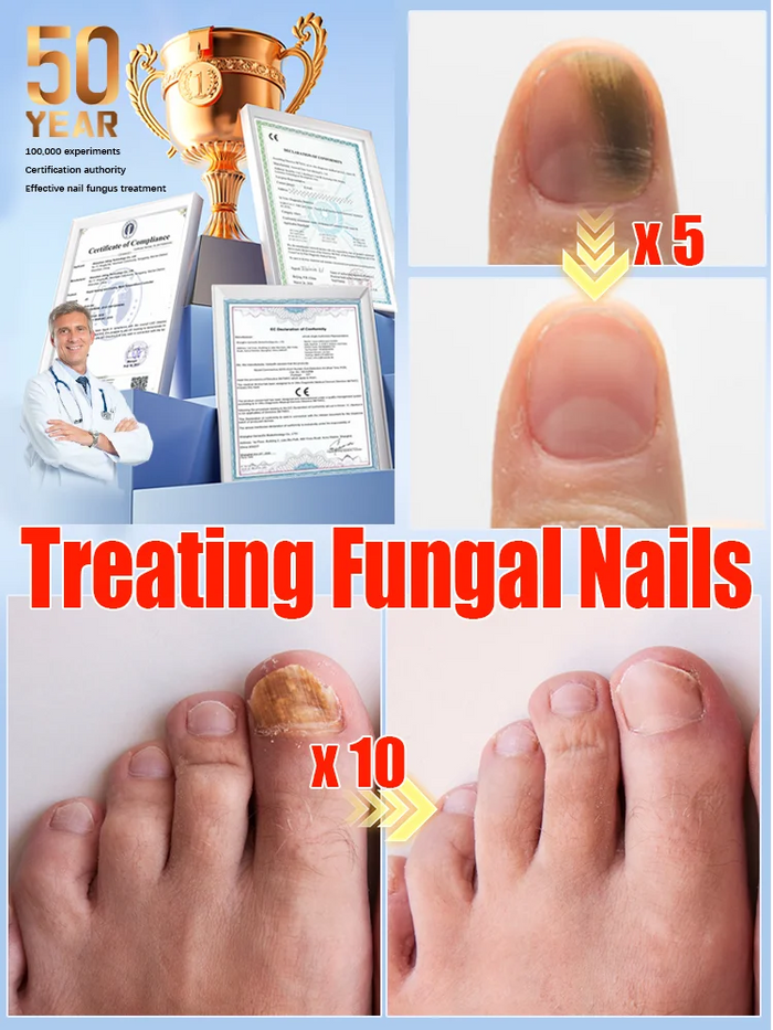 Quickly eliminate fungus and restore healthy nails