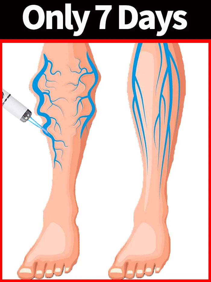 Technology solves leg care problems; best-selling leg care tools, suitable for both men and women.