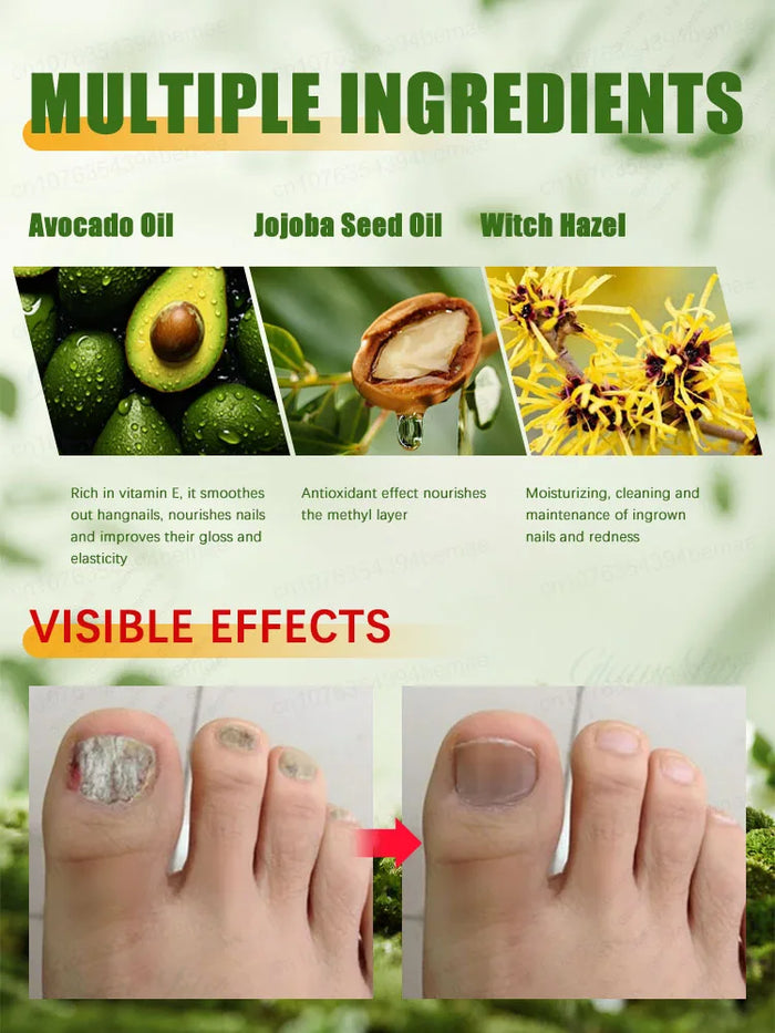 Quickly eliminate fungus and restore healthy nails