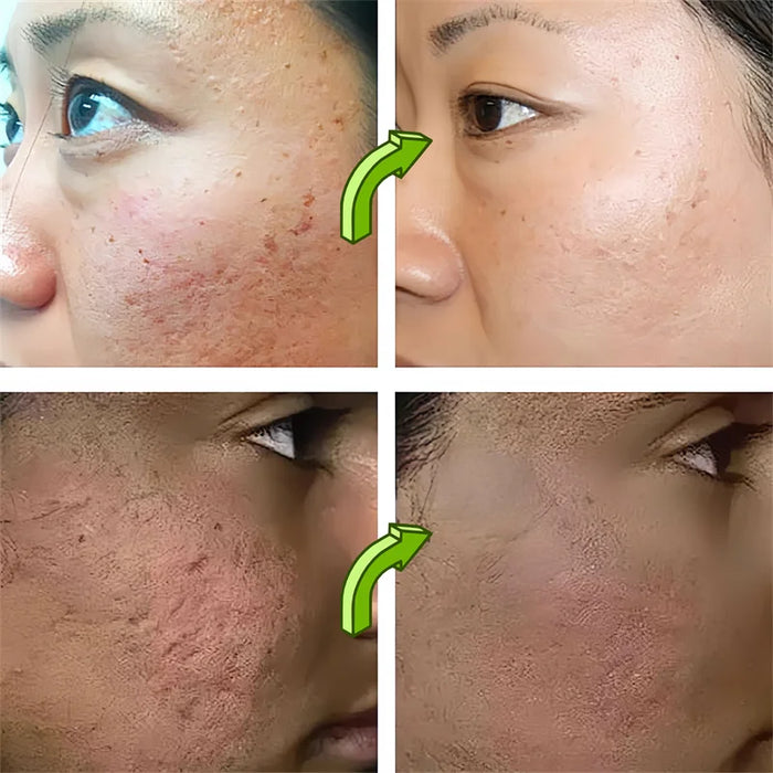 Clean Pores Serum Facial Delicate Tender Moisturizing Oil Control Shrink Pores Rough Skin Smooth Care Brighten Korean Cosmetics