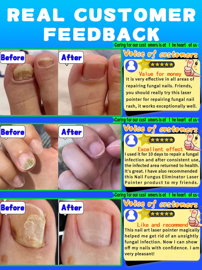 Anti-mold and anti-bacterial technology, restoring nails to their natural shine