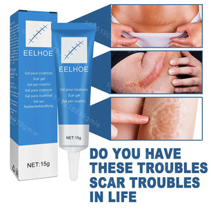 Recovery Scar Cream Fast Removal Skin Scars Treat Surgery Scars Stretch Marks Acne Pox Prints Burn Repair Facial Care Gel