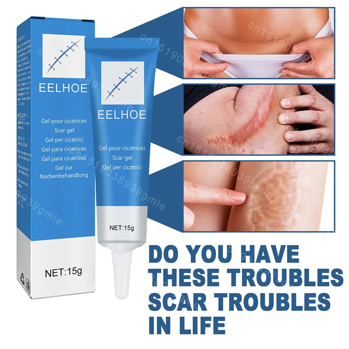 Recovery Scar Cream Fast Removal Skin Scars Treat Surgery Scars Stretch Marks Acne Pox Prints Burn Repair Facial Care Gel