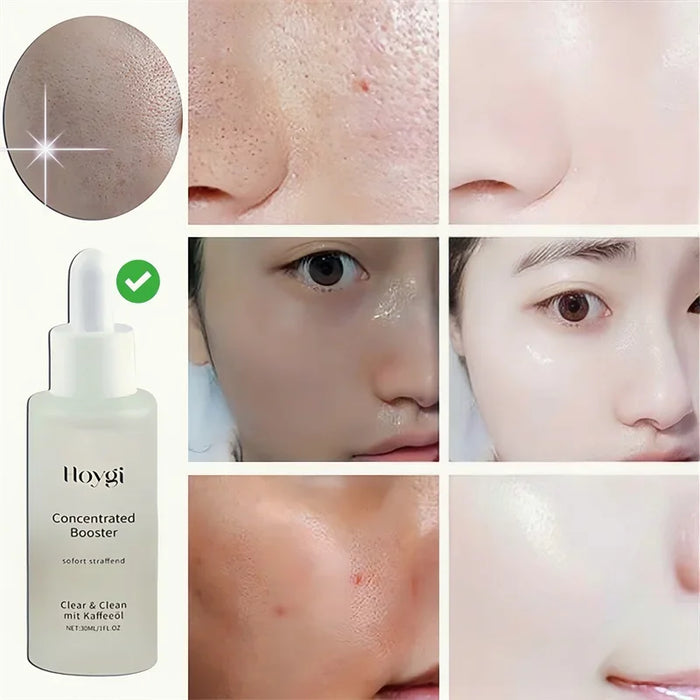 Clean Pores Serum Facial Delicate Tender Moisturizing Oil Control Shrink Pores Rough Skin Smooth Care Brighten Korean Cosmetics