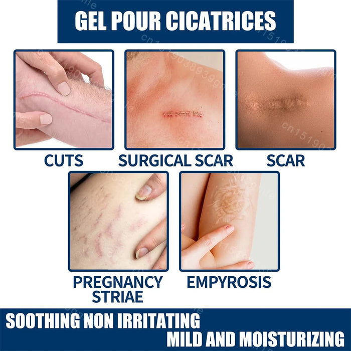 Recovery Scar Cream Fast Removal Skin Scars Treat Surgery Scars Stretch Marks Acne Pox Prints Burn Repair Facial Care Gel
