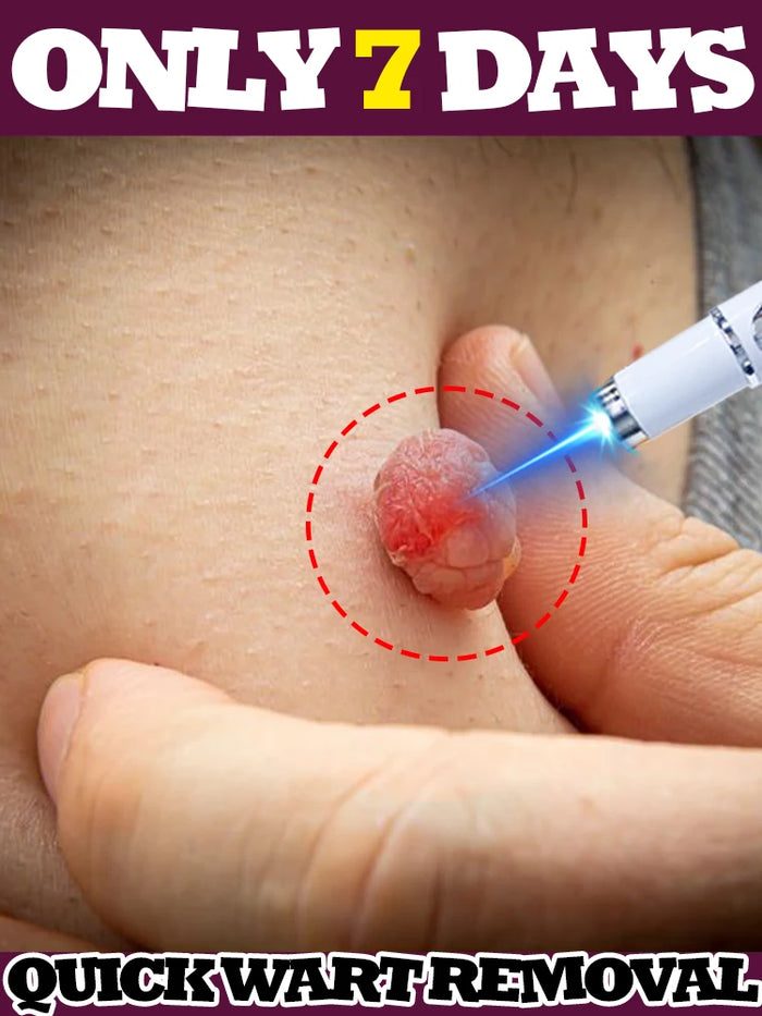 ᵂᵃʳᵗ ʳᵉᵐᵒᵛᵃˡ at the speed of light, giving you flawless skin