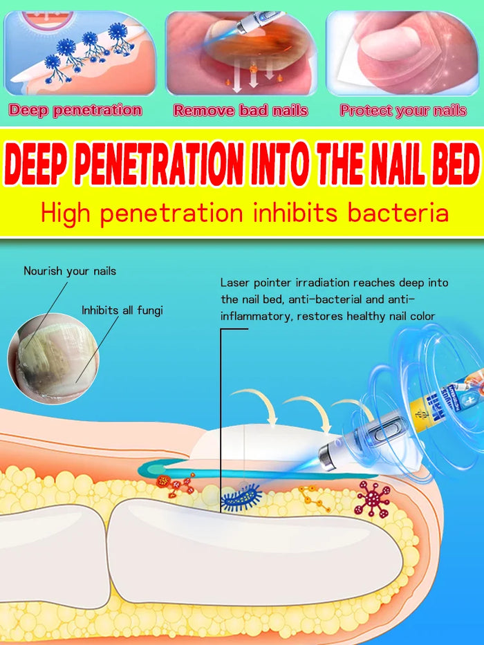 Anti-mold and anti-bacterial technology, restoring nails to their natural shine